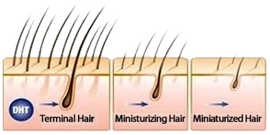 Ultra Fx10 Hair Loss Supplement