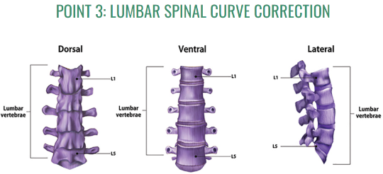 Lumbar Spinal Curve Correction