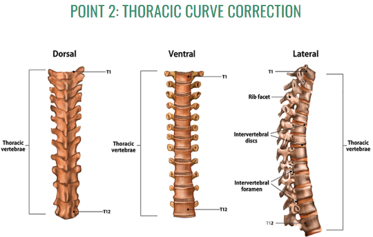 Thoracic Curve Correction