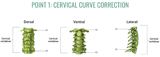 Cervical Curve Correction